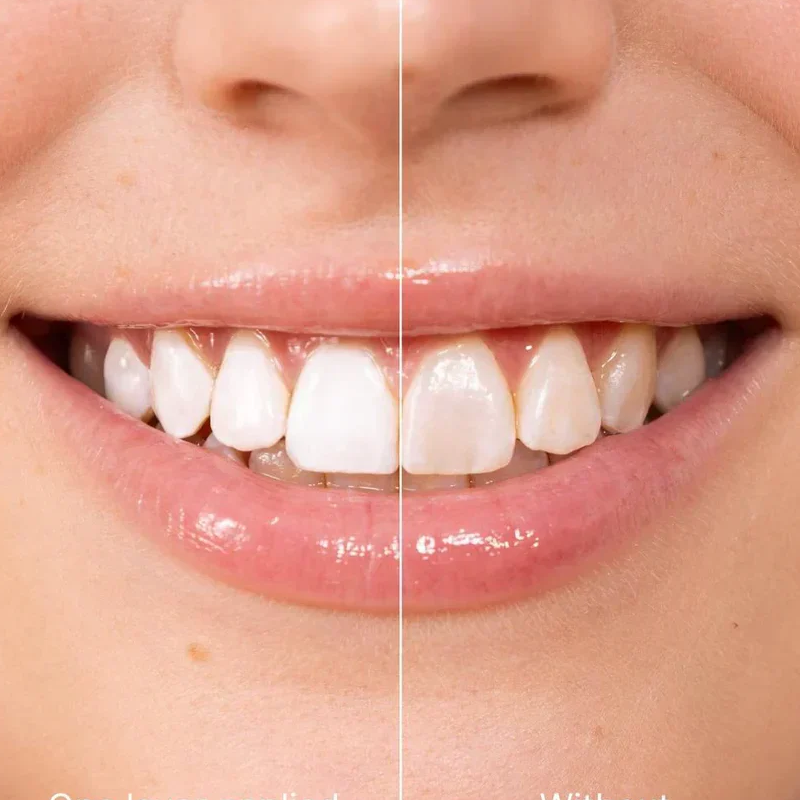 🏆2026 New Arrivals - 50% Off!🧴Instant Whitening Tooth Paint